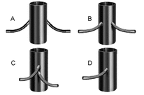 SYMALIT-Fundamentrohre für Beleuchtungsmasten