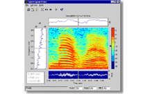 Signal Processing Toolbox 6.11